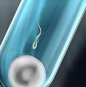 胎儿18三体综合征高风险和孕期没吃叶酸有关系吗？