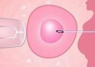 2026永城市最新男性陪产假有多少天？试管婴儿可以增加产假吗？